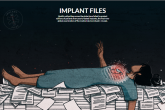 ICFJ objavila istraživanje o opasnosti medicinskih implantata